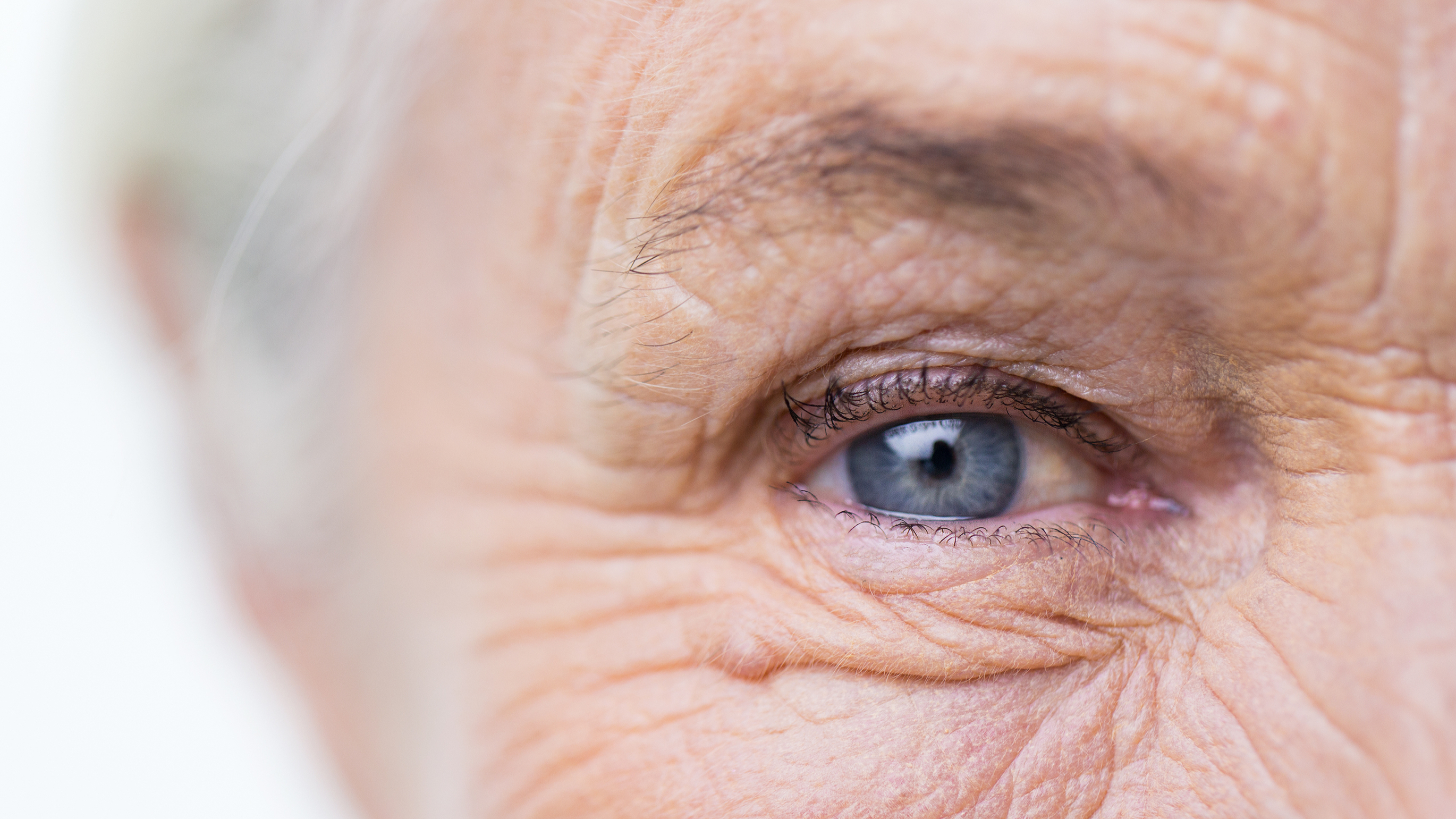 Wonkhe eye wrinkles